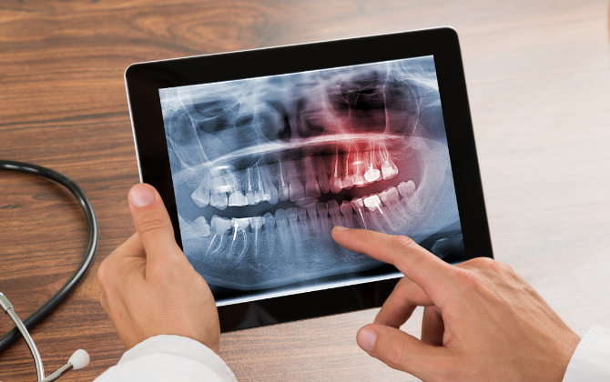 A dentist holding a tablet with an x-ray image of a teeth.