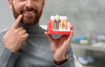 A man with a beautiful smile pointing holding a model of dental implant and pointing at his teeth